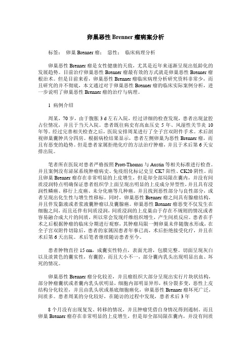 卵巢恶性Brenner瘤病案分析