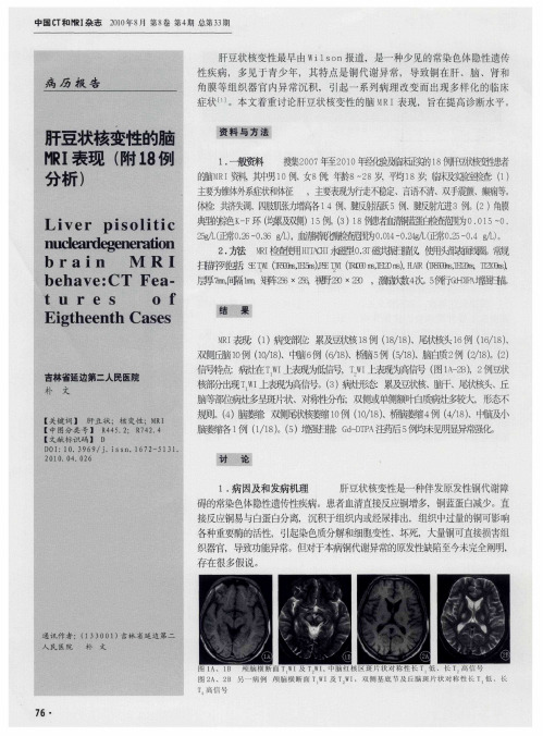 肝豆状核变性的脑MRI表现(附18例分析)