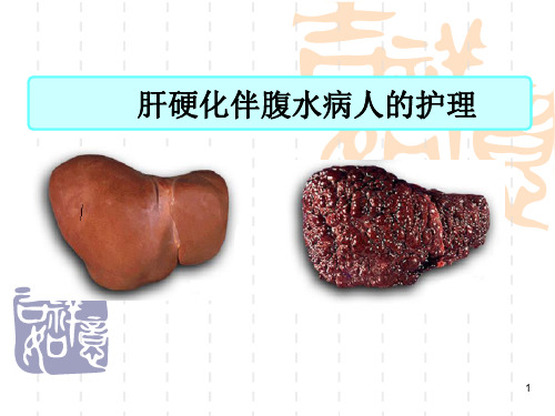 肝硬化病人的护理讲诉