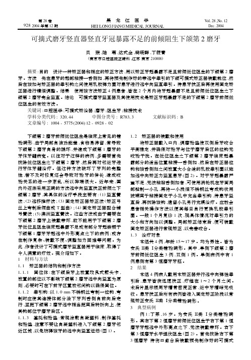 可摘式磨牙竖直器竖直牙冠暴露不足的前倾阻生下颌第2磨