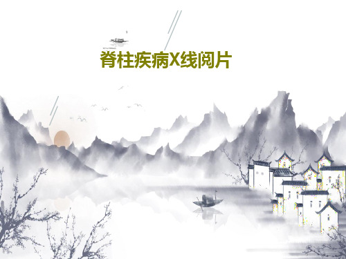 脊柱疾病X线阅片PPT文档共49页