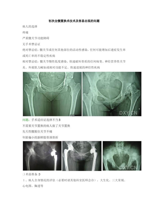 初次全髋置换术的手术技术和容易出现的问题