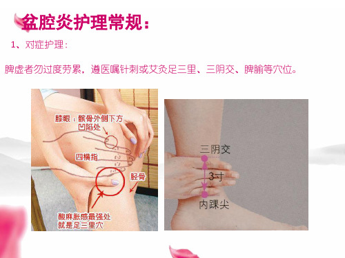 盆腔炎护理常规精品PPT课件