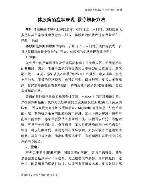体股癣的症状表现 教你辨析方法