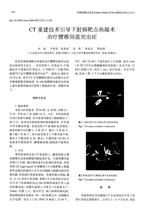 CT重建技术引导下射频靶点热凝术治疗腰椎间盘突出症