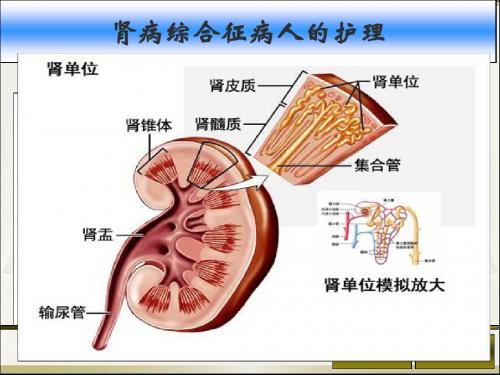 肾病综合征护理查房