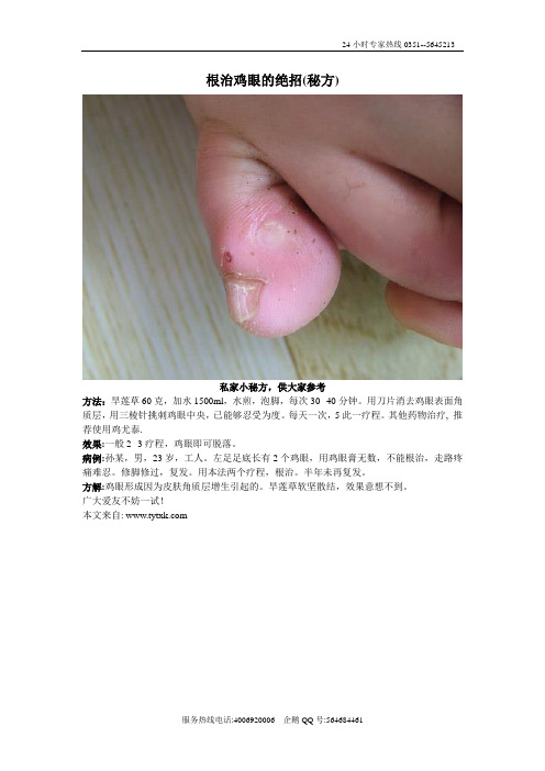 根治鸡眼的绝招(秘方)