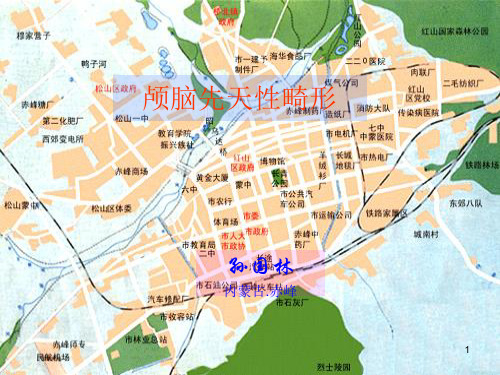先天性畸形PPT参考幻灯片