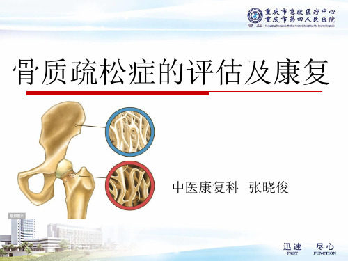 骨质疏松症的评估与康复