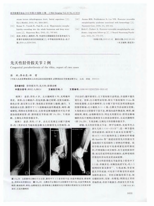 先天性胫骨假关节2例