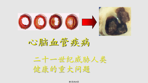 脉搏波传导速的临床应用荟萃PPT课件