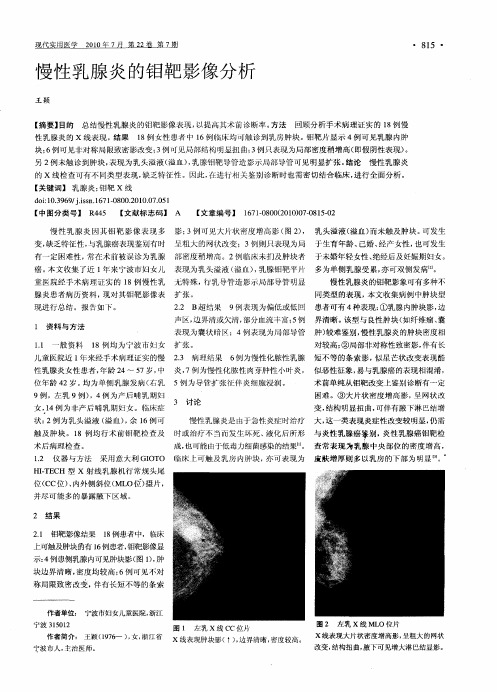 慢性乳腺炎的钼靶影像分析