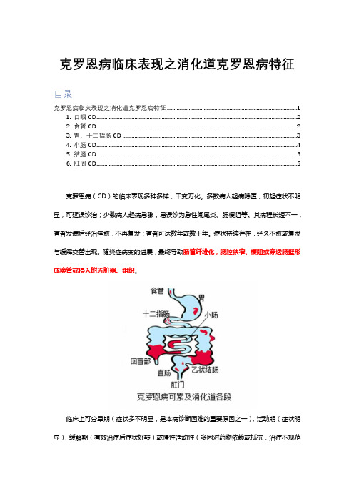 克罗恩病临床表现之消化道克罗恩病特征