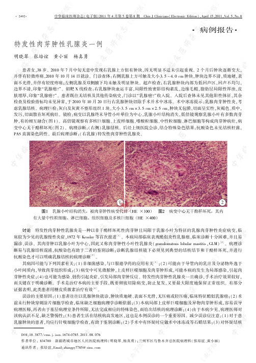 特发性肉芽肿性乳腺炎一例