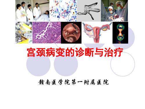 宫颈病变诊治课件