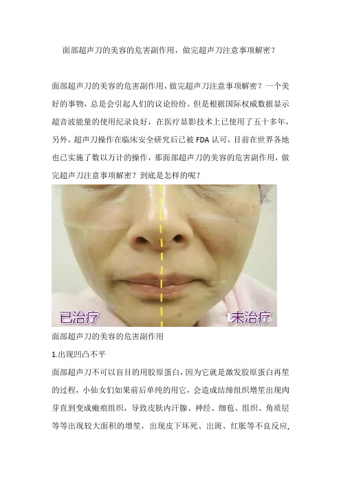 面部超声刀的美容的危害副作用,做完超声刀注意事项解密？