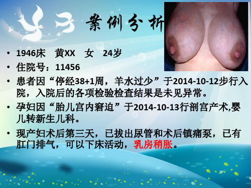 产后乳胀的护理课件