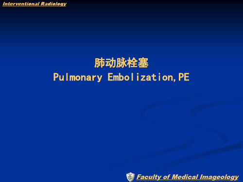 肺动脉栓塞的介入治疗
