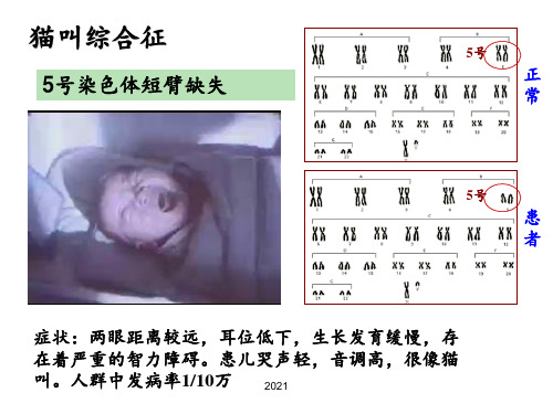 染色体畸变PPT课件_1