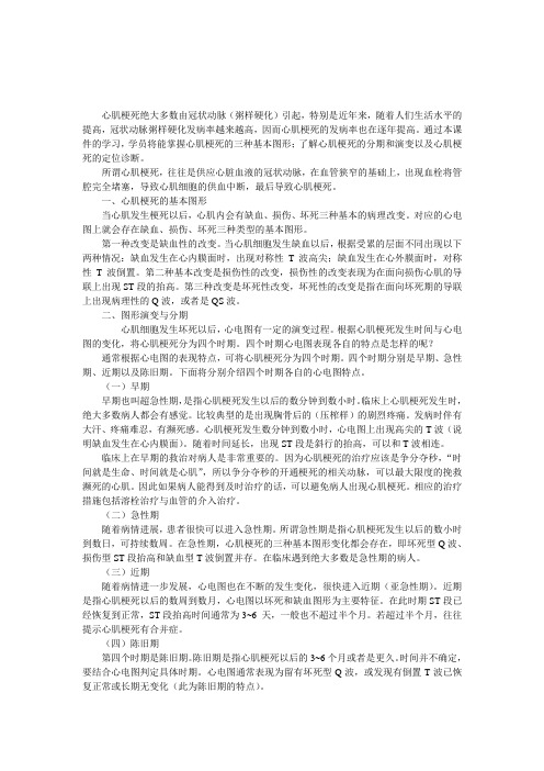 心肌梗死