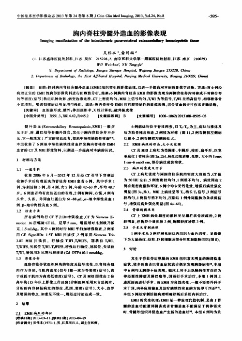 胸内脊柱旁髓外造血的影像表现