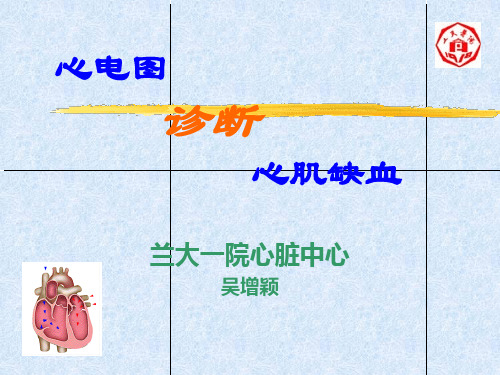 心电图诊断心肌缺血