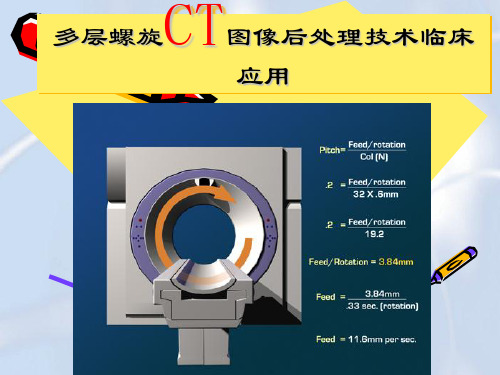CT图像后处理技术