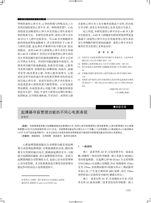起搏器夺获管理功能的不同心电图表现
