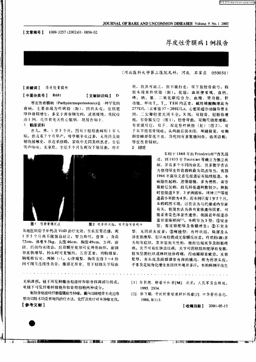 厚皮性骨膜病1例报告