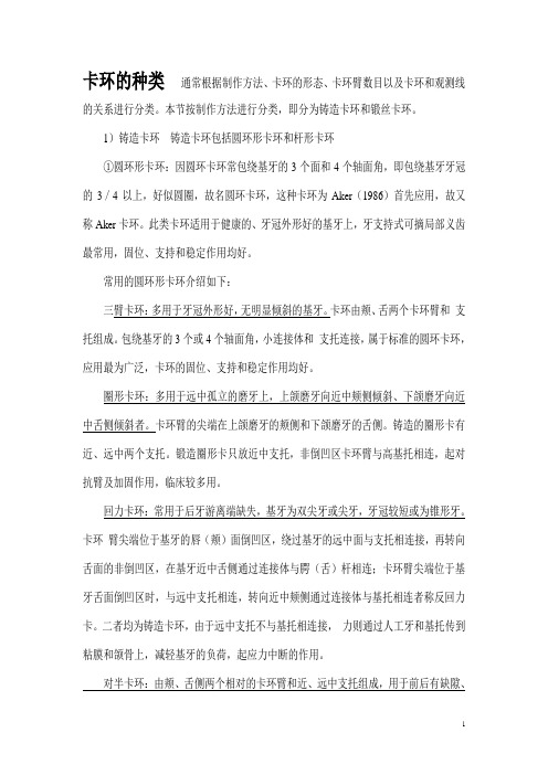 卡环的种类