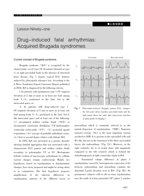 第91课药物诱发的致命性心律失常-获得性Brugada综合征
