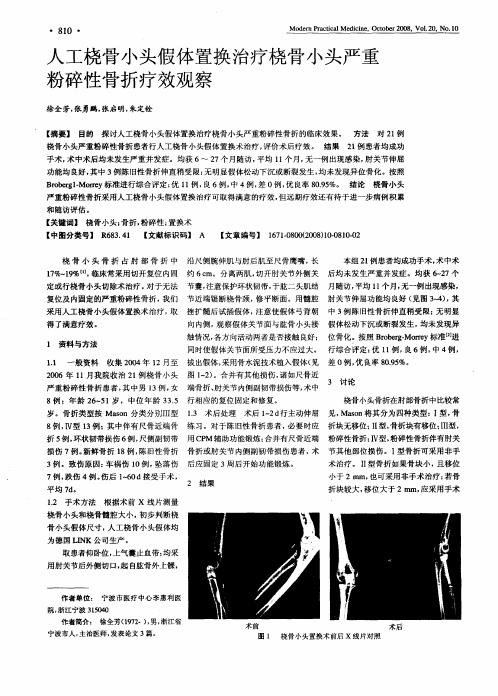 人工桡骨小头假体置换治疗桡骨小头严重粉碎性骨折疗效观察