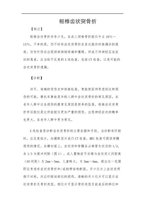 枢椎齿状突骨折
