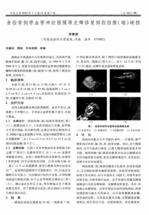 食指背侧带血管神经筋膜蒂皮瓣修复拇指指腹(端)缺损