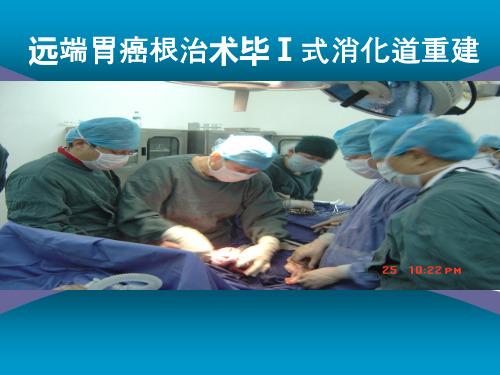 远端胃癌根治术毕Ⅰ式消化道重建PPT课件