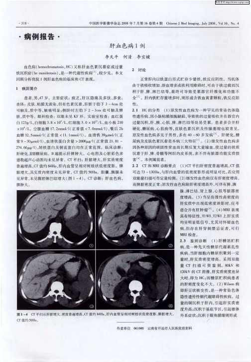肝血色病1例