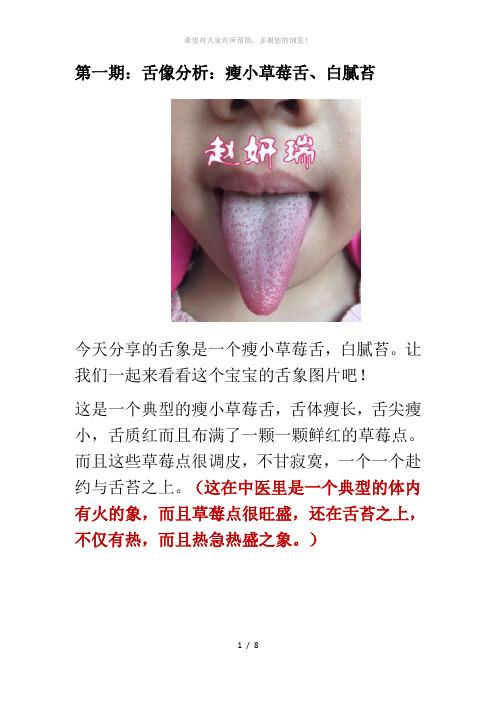 舌像分析：瘦小草莓舌、白腻苔