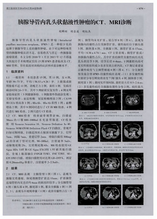 胰腺导管内乳头状黏液性肿瘤的CT、MRI诊断