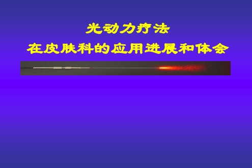 光动力