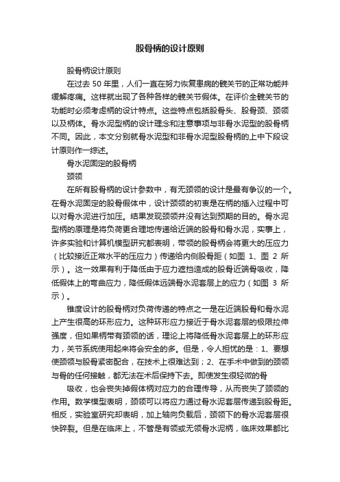 股骨柄的设计原则