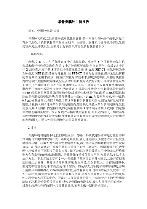掌骨骨囊肿1例报告