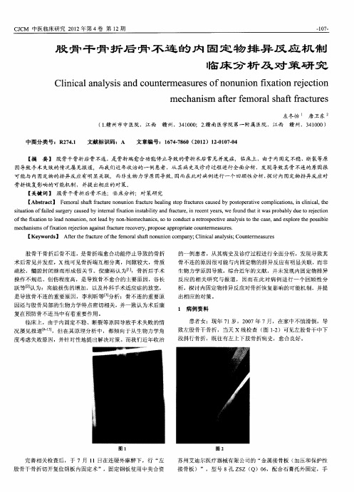 股骨干骨折后骨不连的内固定物排异反应机制临床分析及对策研究