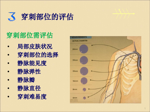 穿刺部位的评估ppt课件