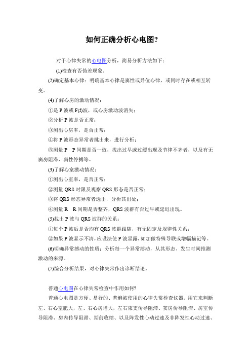 如何正确分析心电图