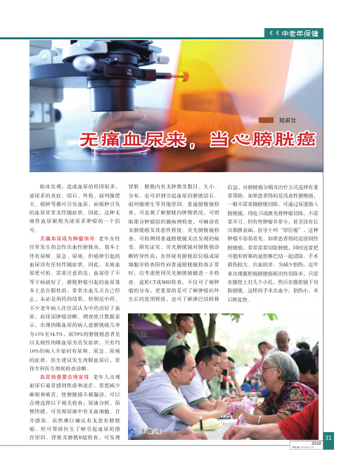 无痛血尿来,当心膀胱癌