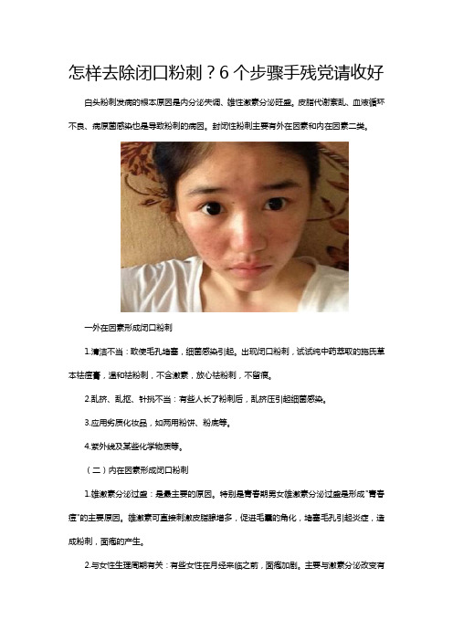 怎样去除闭口粉刺？6个步骤手残党请收好