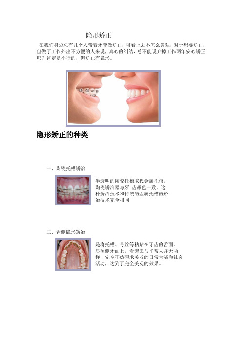 隐形矫正、箍牙