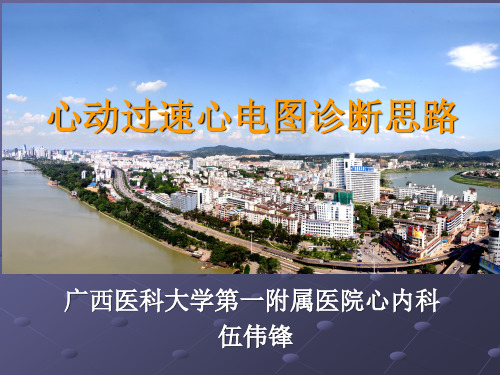 心动过速心电图诊断思路