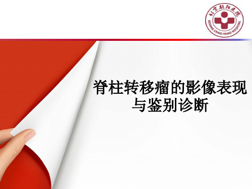 脊柱转移瘤的影像表现与鉴别诊断ppt课件