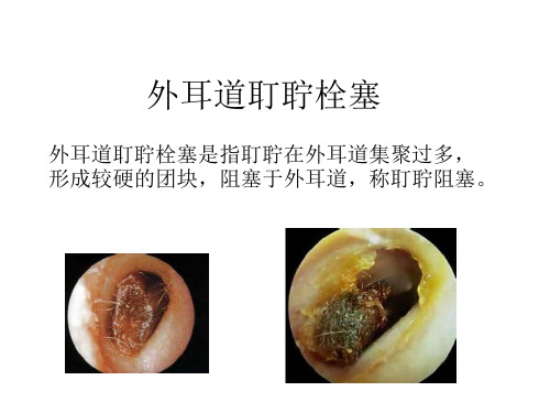 耳鼻咽喉头颈外科学2.3.5